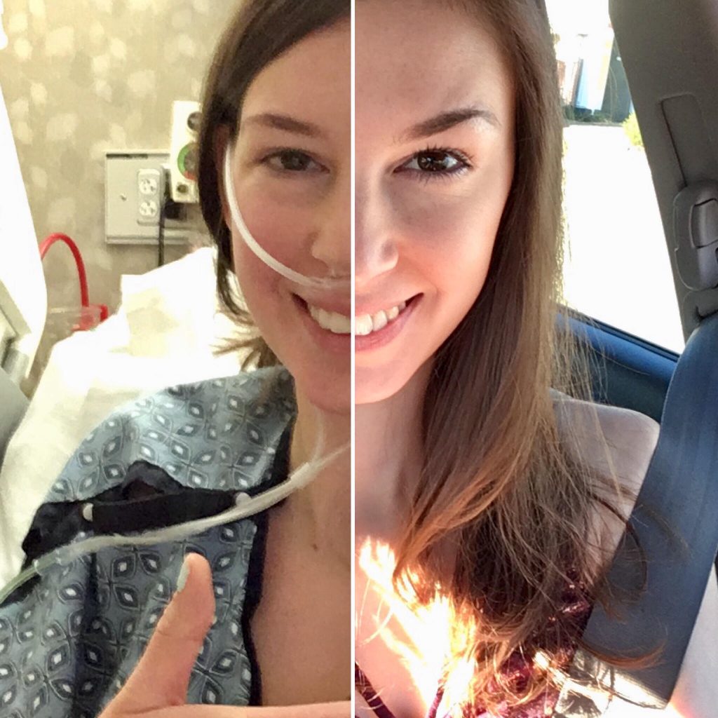 Split image of Jenna. Half her face is from a hospitalization wearing an oxygen tube and the other half is Jenna sitting in the car looking happy and healthy