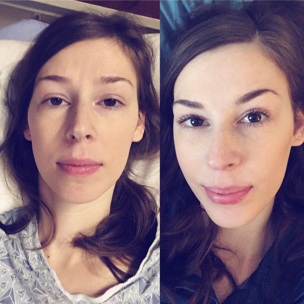 Side-by-side selfies of Jenna looking sick in a hospital bed and Jenna looking healthy.